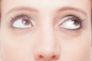 目の下のたるみ改善法！老け顔を解消するエクササイズと5つの対策法