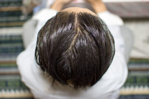 若白髪を改善する5つの方法！原因や効果的な対処法とは